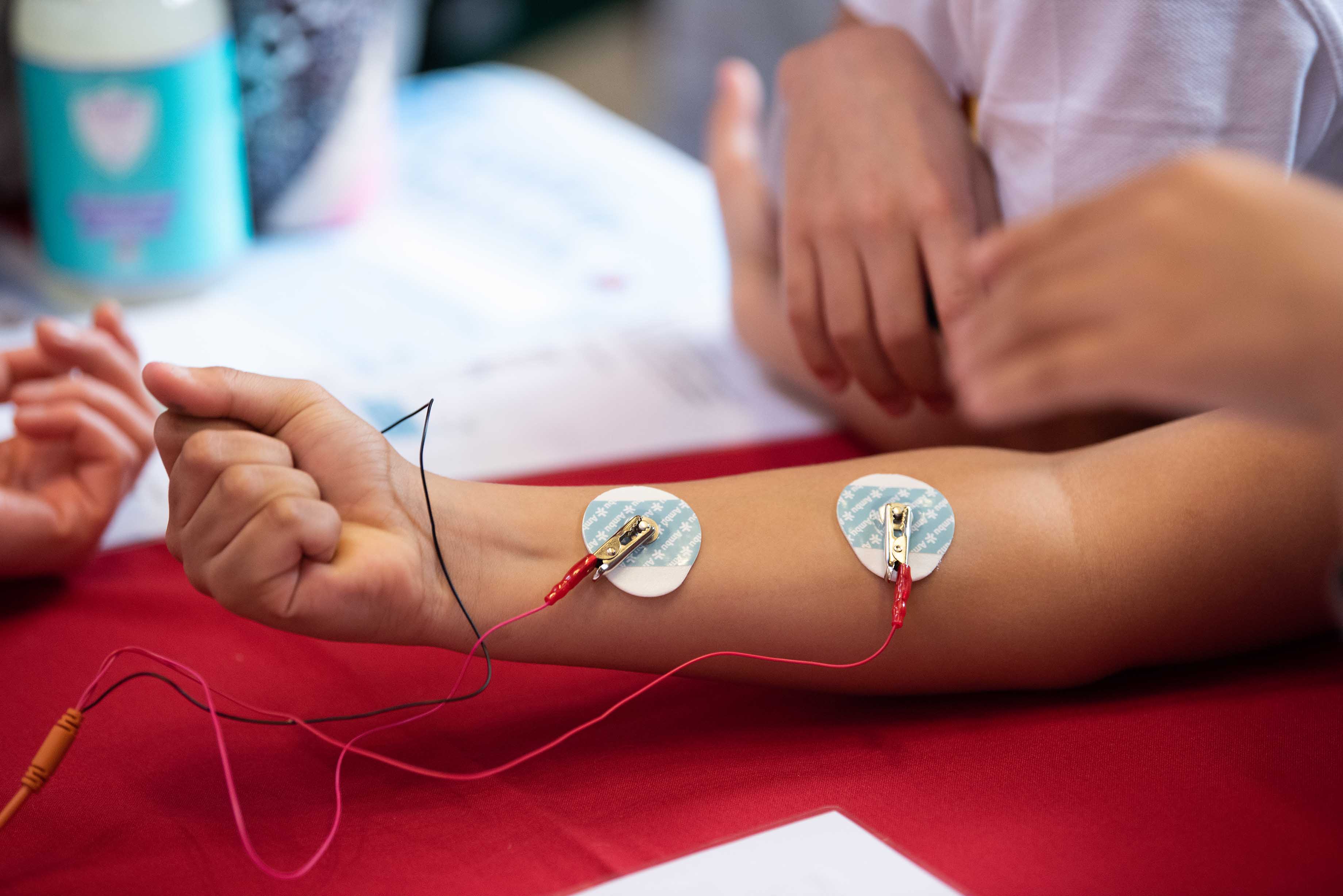 Placing electric-pulse-conducting pads on the arm